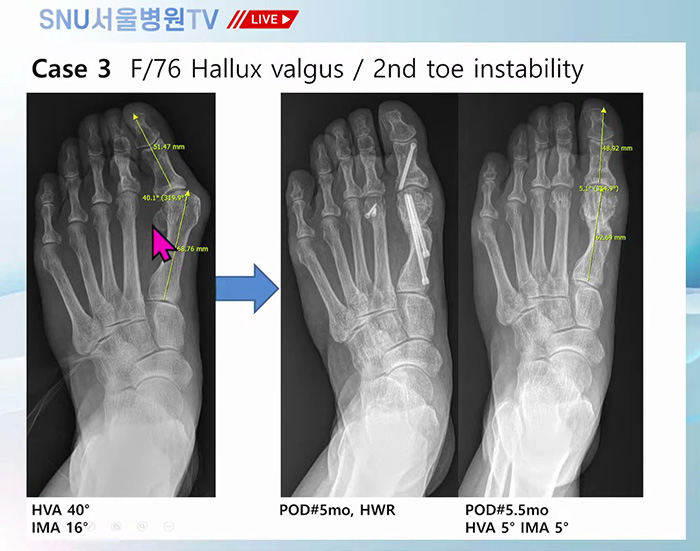 58ba35d7a9f6c94d5b8fac9f1811b8d2_1761789141_1802.jpg 58ba35d7a9f6c94d5b8fac9f1811b8d2_1761789141_1802.jpg