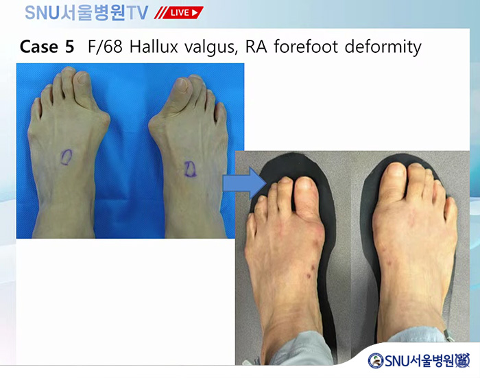 58ba35d7a9f6c94d5b8fac9f1811b8d2_1761789141_2786.jpg 58ba35d7a9f6c94d5b8fac9f1811b8d2_1761789141_2786.jpg