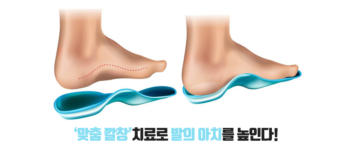 깔창부주상골