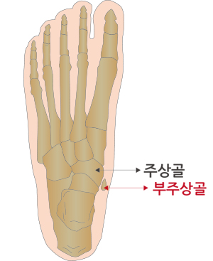 무릎클리닉2