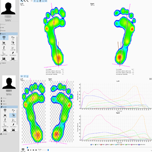 보행족압분석 사진4